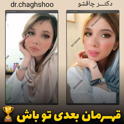 nomoneh5 نمونه های رژیم غذایی آنلاین اندام زیبا