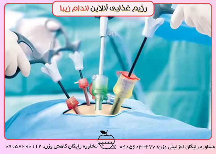 عمل لاغری لاپاراسکوپی