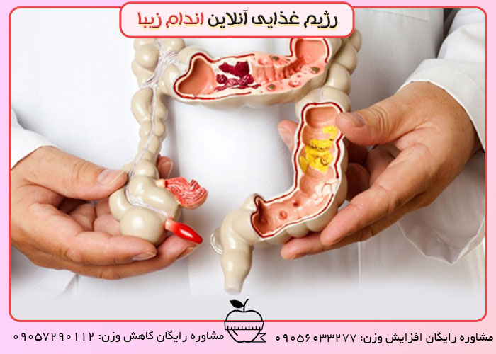 علت بروز روده تحریک پذیر چیست؟