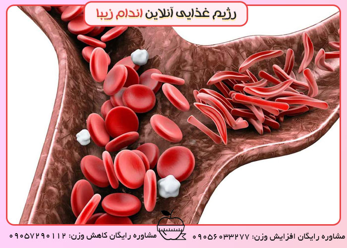 انواع کم خونی