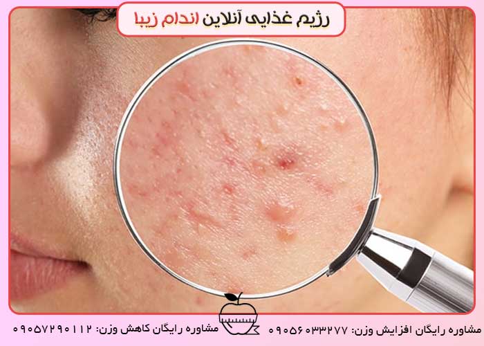 برخی از علائم و نشانه‌ های کبد چرب