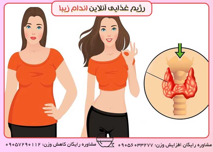Thyroid-gland-and-its-effect-on-thinness-and-obesity غده تیرویید و تاثیر آن بر لاغری و چاقی بدن